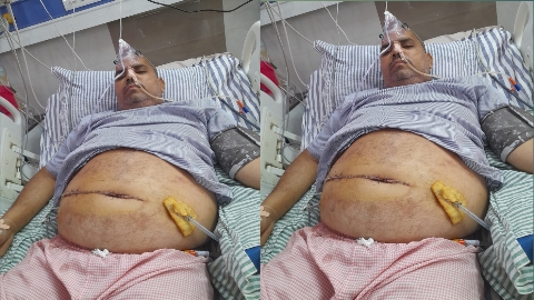 खेत में पेड़ लगाने के विवाद में मारपीट, हसुआ से पेट फाड़ा